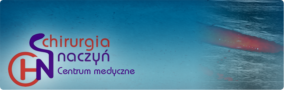 Chirurgia Naczyń Kraków - żylaki, skleroterapia